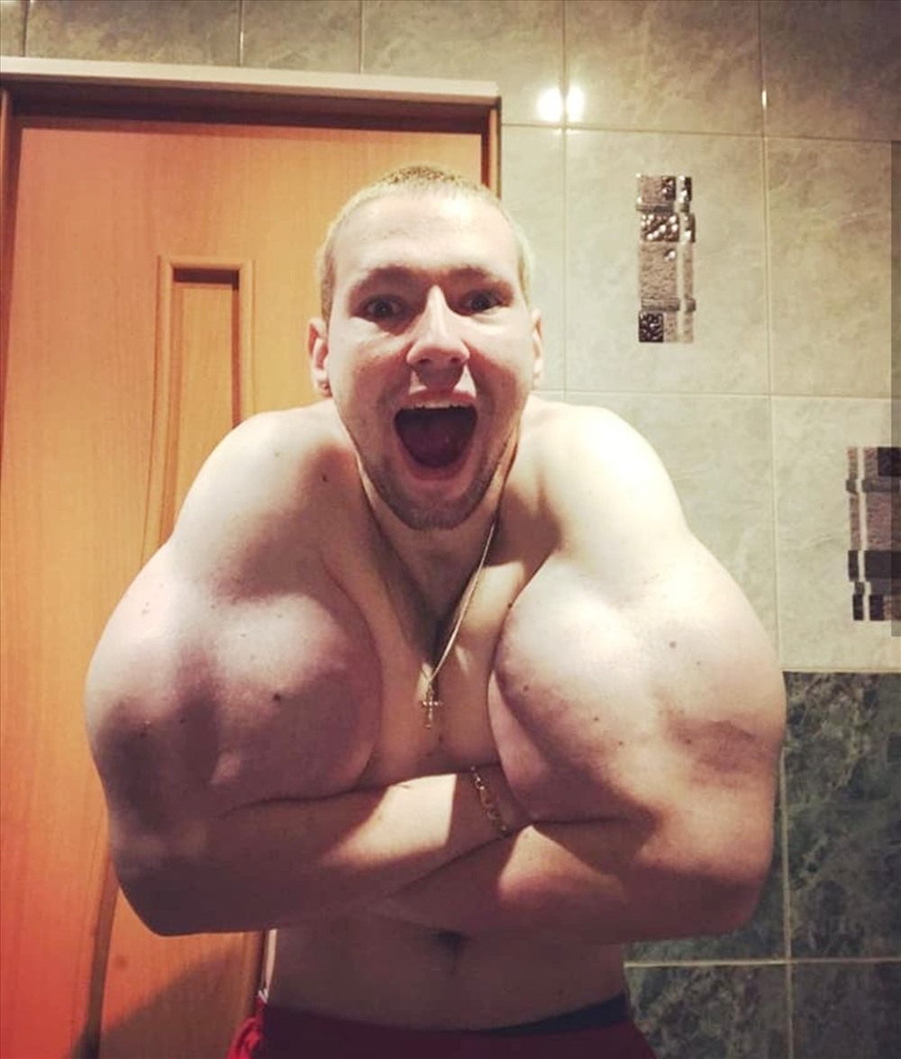 Cơ thể mất cân đối của Kirill Tereshin