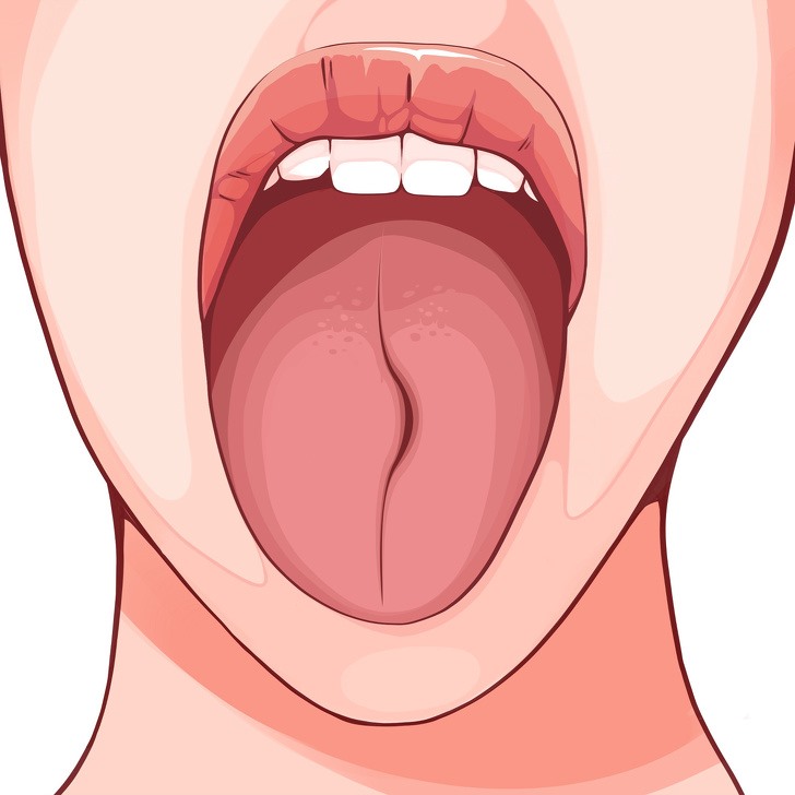 3 hình dạng bất thường của lưỡi cho thấy có thể bệnh tuyến giáp đang âm  thầm phát triển trong cơ thể cần đi khám ngay