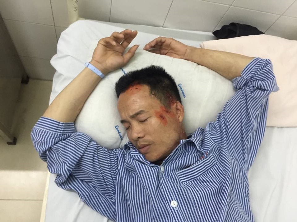 Anh Nguyễn Thành Long đã gửi đơn tới cơ quan công an đề nghị xử lý nhóm côn đồ hành hung anh - ảnh HH