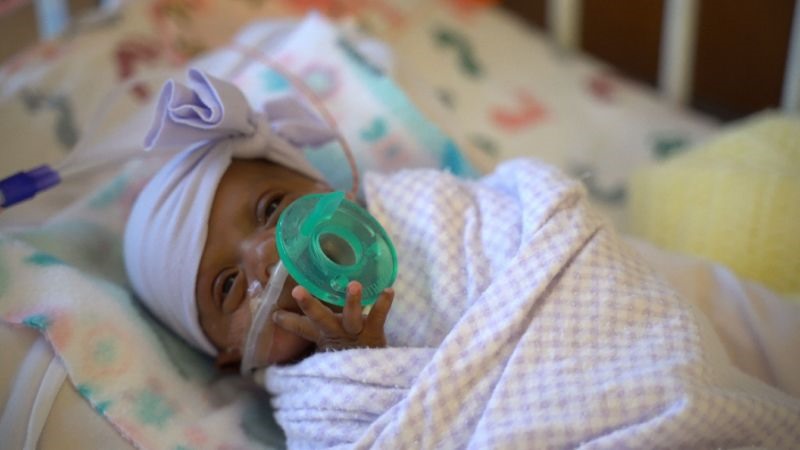 Vào thời điểm chào đời, bé Saybie chỉ nặng bằng một trái tráo hay một hộp nước trái cây của trẻ em. Ảnh: AFP.