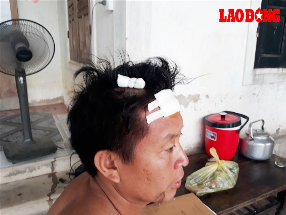 Anh Nguyễn Thu Hải bị đối tượng đánh trong thương. Ảnh: Hùng Trần