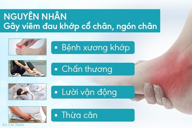 Các nguyên nhân gây viêm đau khớp cổ chân, ngón chân thường gặp