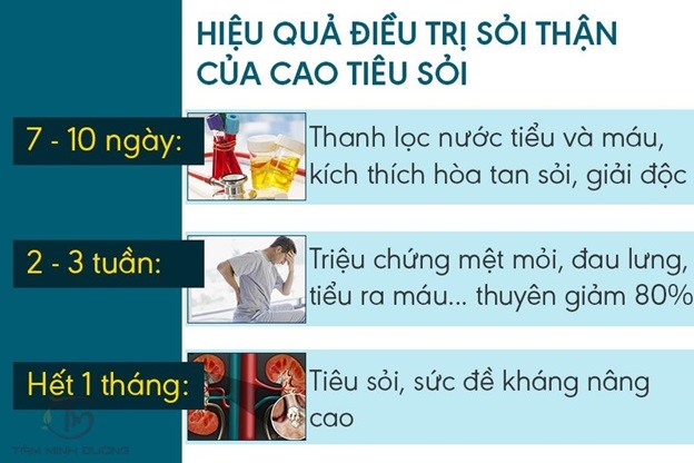 Hiệu quả điều trị sỏi thận của Cao Tiêu Sỏi Tâm Minh Đường