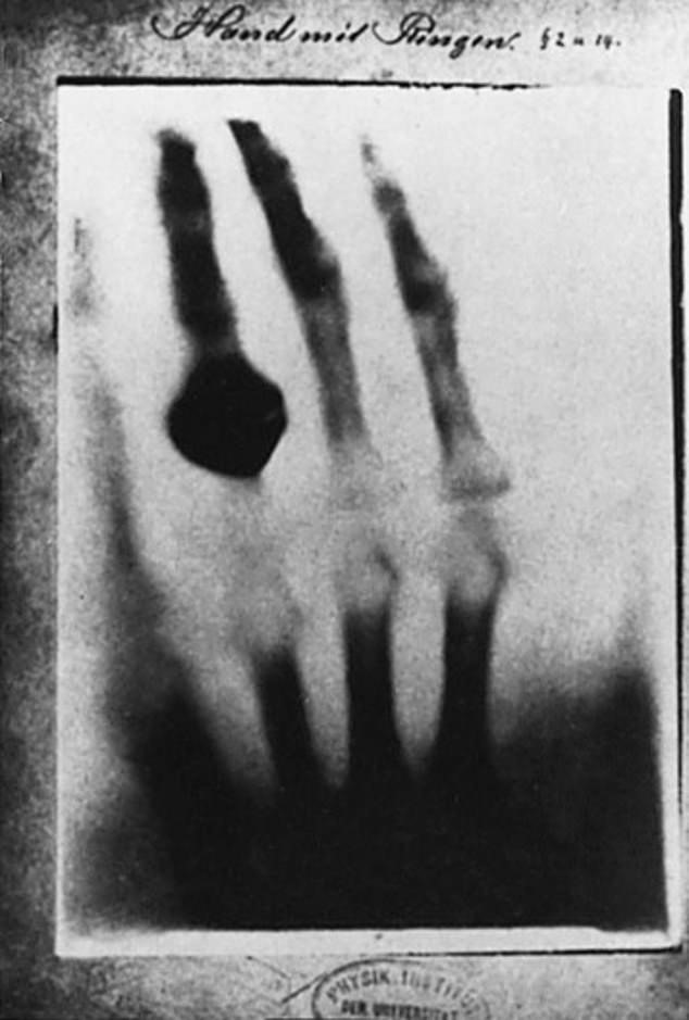 Bức ảnh tia X-quang đầu tiên làm chấn động thế giới nhưng không ngờ đằng sau nó là sự thật đau đớn.