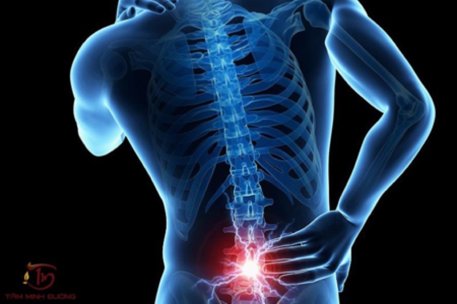 Hình ảnh cơn đau thắt lưng ở nam giới (Ảnh minh họa)