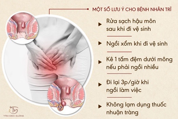 Một số lưu ý trong chế độ ăn uống khi bị trĩ bệnh nhân cần chú ý