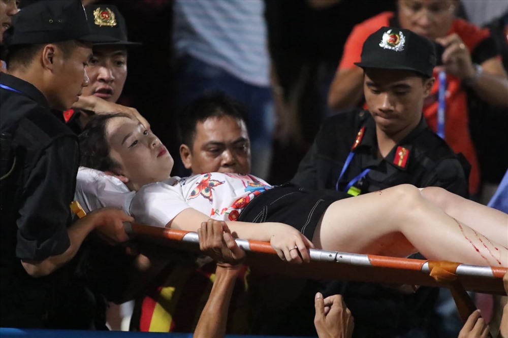 Nữ CĐV bị pháo sáng bắn thẳng vào đùi trong trận đấu giữa Hà Nội và Nam Định trên sân Hàng Đẫy (Ảnh: Trần Tiến)