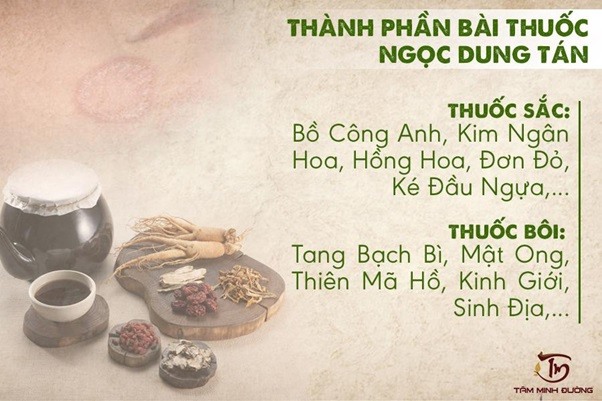 Chữa hắc lào nhanh hơn, hiệu quả hơn nhờ Ngọc Dung Tán