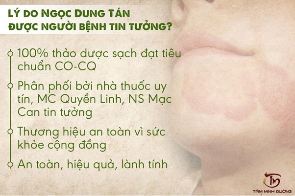 Những ưu điểm nổi bật của bài thuốc Ngọc Dung Tán