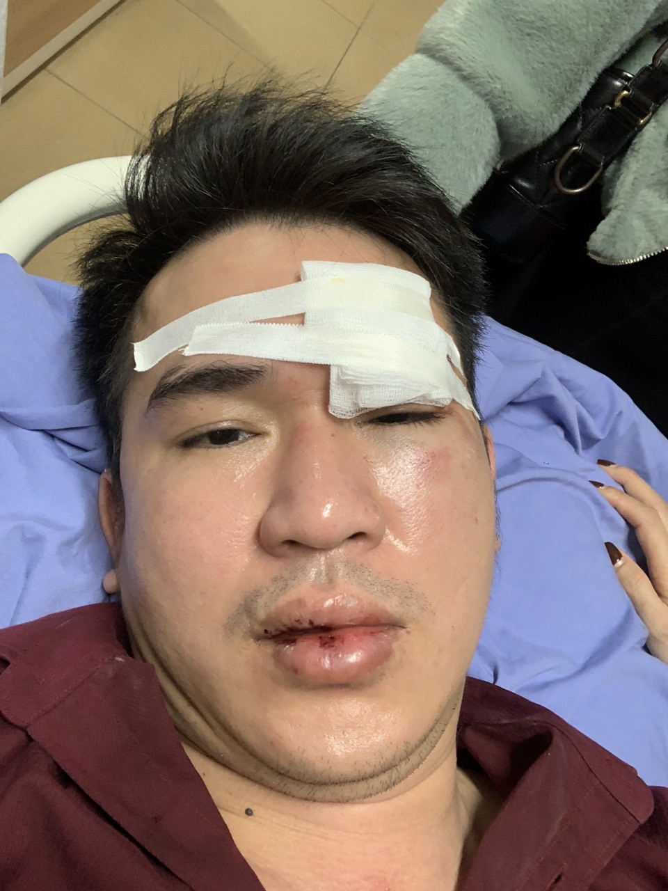 Anh Tuyến hiện đang được điều trị tại Bệnh viện Việt Đức.