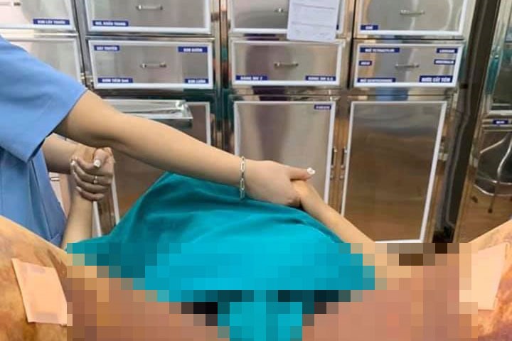 2 bên đùi của bệnh nhân bị hoại tử sau khi hút mỡ tại thẩm mỹ viện Việt Hàn. Ảnh BS cung cấp.