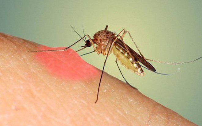 Có thể phòng bệnh sốt xuất huyết bằng cách tránh muỗi đốt, với những mẹo dễ làm.