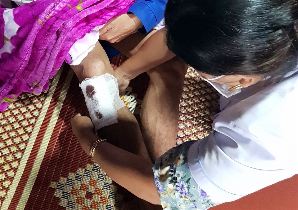 Nhân viên Trạm Y tế xã Hướng Sơn xử lý vết thương ở chân của anh Xuôn. Ảnh: Thế Dũng.