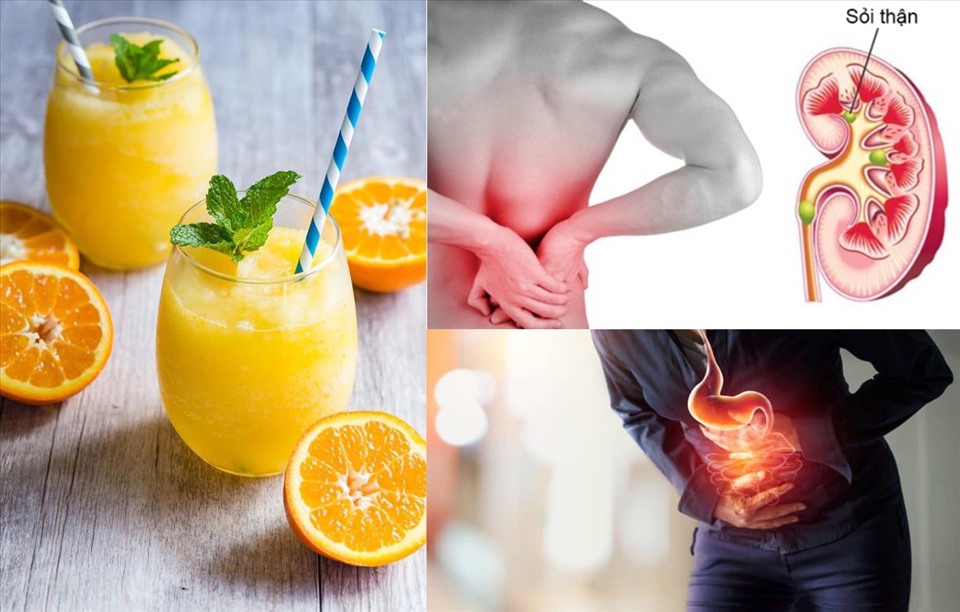 Sử dụng nước cam không hợp lí gây bệnh về tiêu hóa, dạ dày và thận. (Đồ họa: VA)