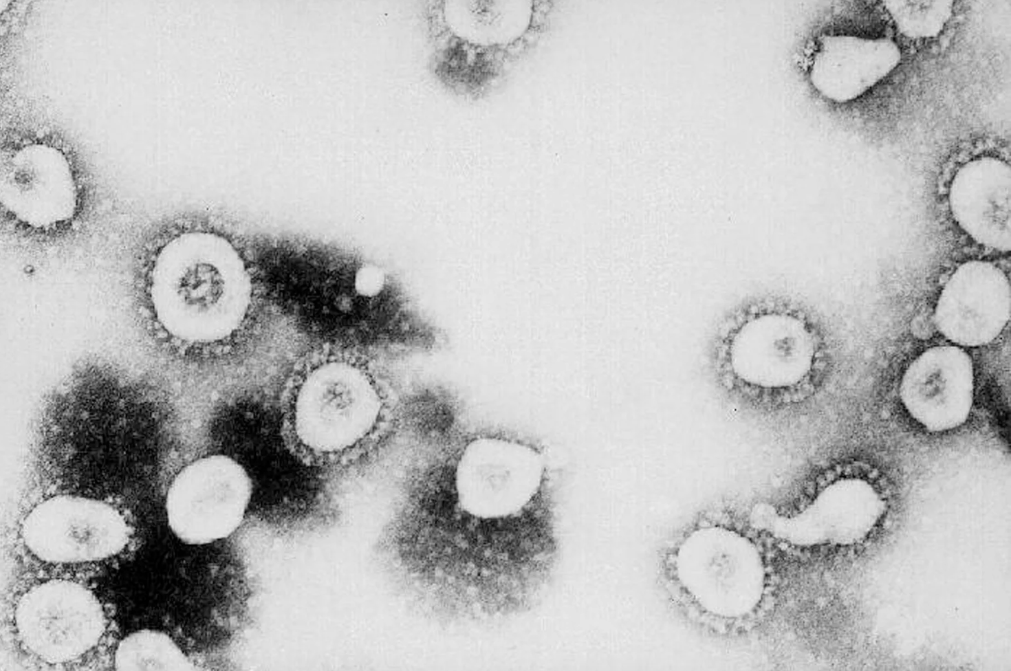 Virus SARS. Ảnh: CDC/Getty Images