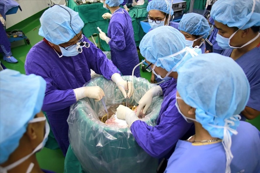 Các bác sĩ bệnh viện Hữu nghị Việt Đức thực hiện ca ghép phổi. Ảnh: BSCC