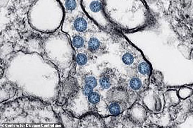 Các virus hoàn chỉnh (chấm màu xanh) xâm nhập và phát triển trong tế bào cơ thể người bệnh. Ảnh: CDC.