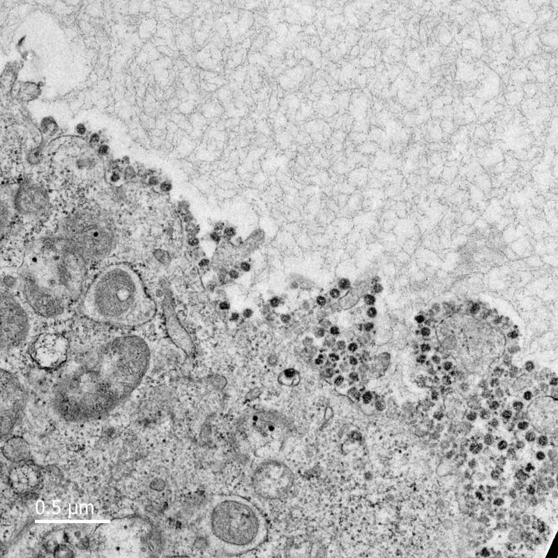 Một hình ảnh virus SARS-CoV-2 phát triển trong các tế bào ở Đại học Hong Kong. Nguồn: Đại học Hong Kong.