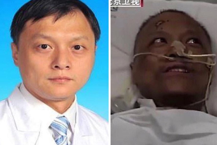 Bác sĩ Yi Fan trước và sau khi mắc COVID-19. Ảnh: Wuhan Central Hospital