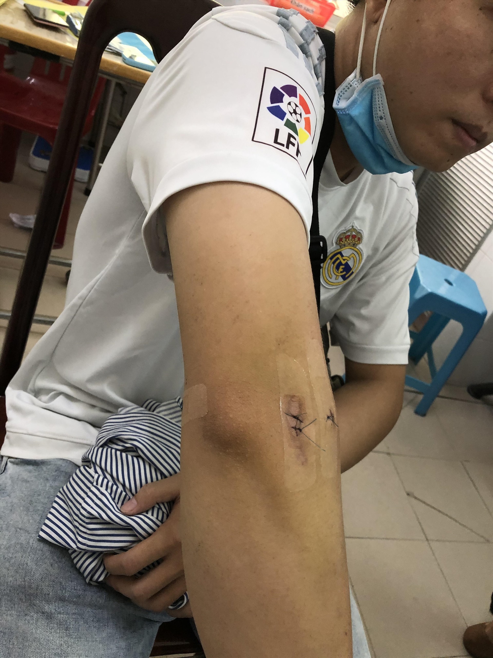 Bệnh nhân Nguyễn Phạm Minh Tùng đến bệnh viện. Ảnh: B.V