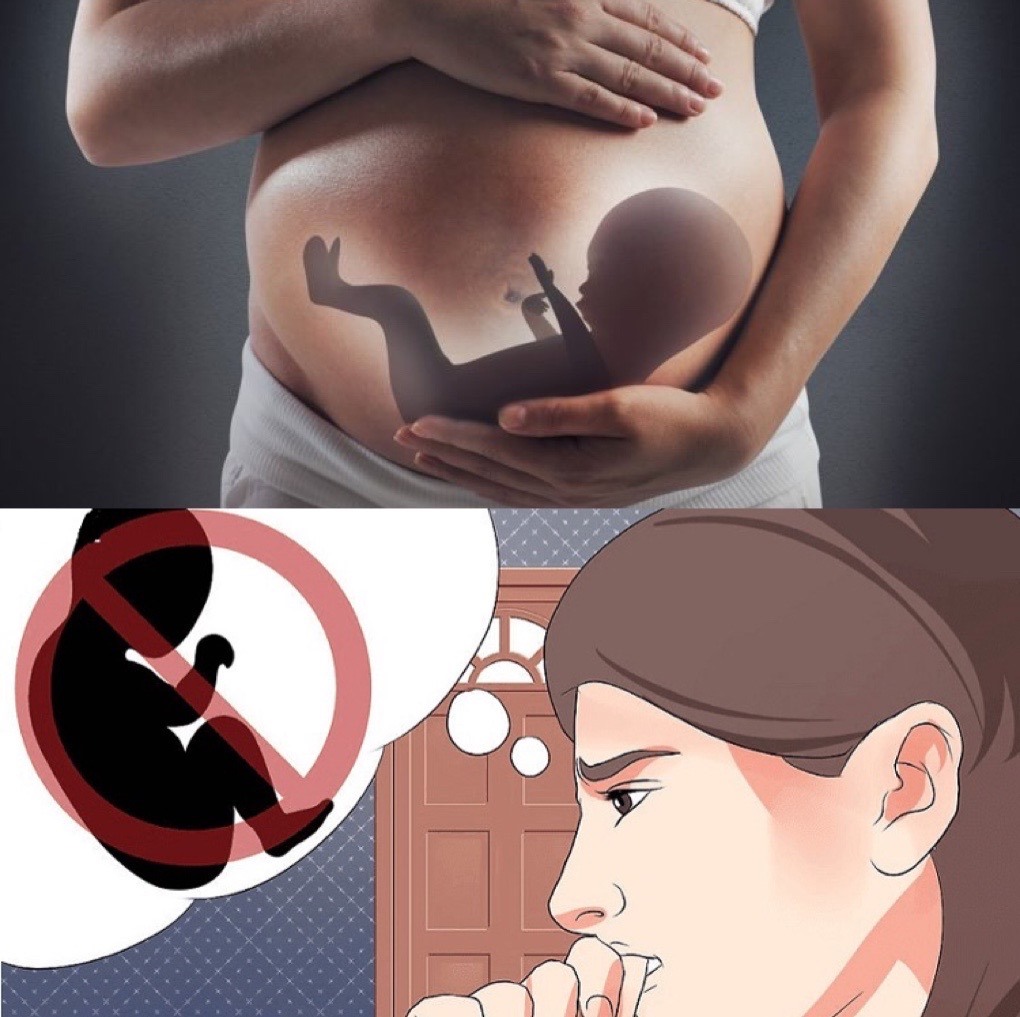 Mang thai ngoài ý muốn là nguyên nhân chủ yếu dẫn đến việc phá thai. Đồ họa: Thanh Bình