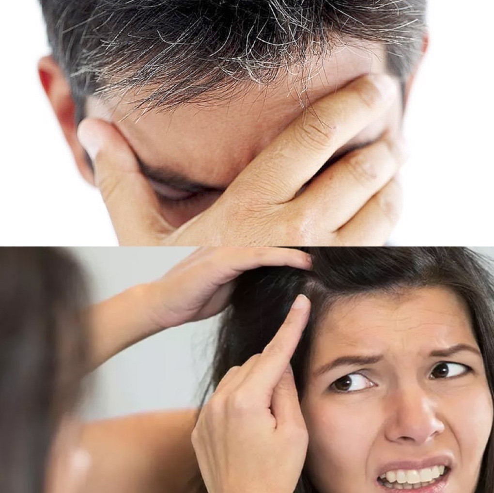 Kích ứng da bởi thuốc nhuộm tóc - VnExpress Sức khỏe