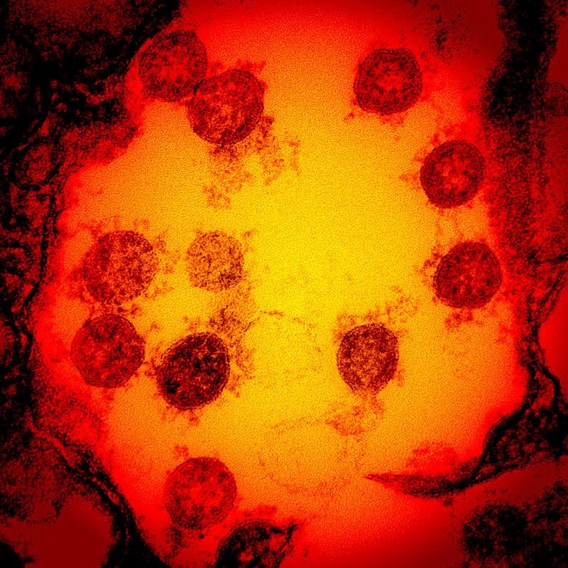 Ảnh vi điện tử được tăng cường màu chụp lại các hạt virus SARS-CoV-2 được phân lập từ một bệnh nhân. Ảnh: NIAID/AFP.