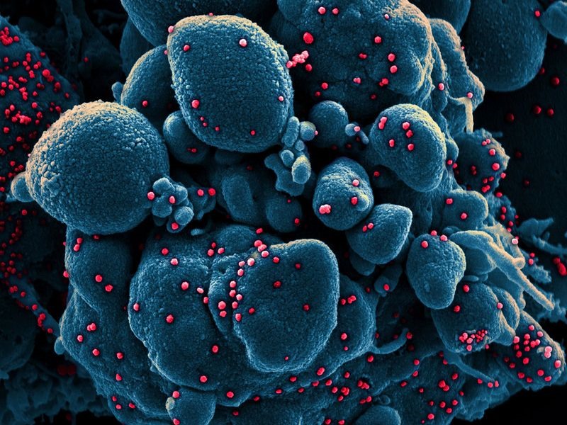 Những bức ảnh này được quét màu và lấy từ các kính hiển vi điện tử truyền qua. Trong ảnh là một tế bào sắp chết bị nhiễm SARS-CoV-2, với các hạt virus có màu đỏ. Ảnh: NIAID.
