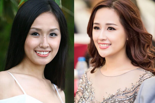 Hoa hậu Mai Phương Thúy trước và sau khi thẩm mỹ.