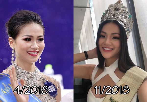 Hoa hậu trái đất Phương Khánh trước và sau khi thẩm mỹ. Ảnh: Hoa hậu trái đất