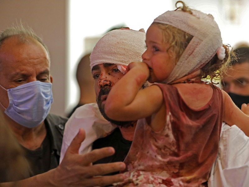 Những người bị thương sau vụ nổ ở Beirut, Lebanon. Ảnh: AFP.