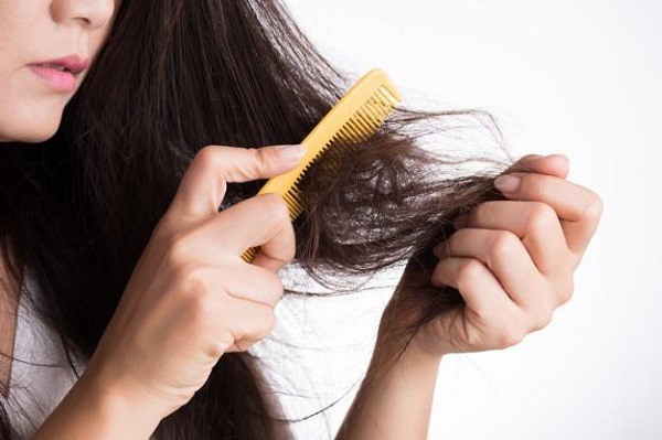 Tóc rụng nhiều và nhanh hơn phần tóc mọc ra sẽ khiến cho tóc mỏng đi và gây tình trạng hói đầu. Ảnh: Vietnamnet