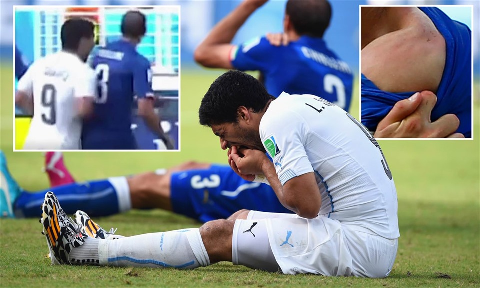 Suarez từng cắn trung vệ người Italia ở World Cup 2014. Ảnh: Daily Mail