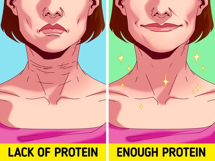 Sai lầm 6: Bổ sung thiếu protein ngăn cản các tế bào da tự tái tạo Nếu bạn hạn chế lượng calo và ăn ít protein, da của bạn sẽ mất độ đàn hồi, từ đó dẫn đến nhiều nếp nhăn hơn. Việc thiếu protein cũng ngăn da tự tái tạo. Bạn có thể điều trị collagen nhưng không thể hiệu quả bằng việc cung cấp đủ protein ngay từ đầu.