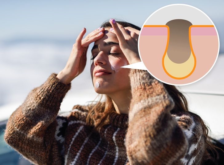 Sai lầm khi chăm sóc da mặt sử dụng sai kem chống nắng