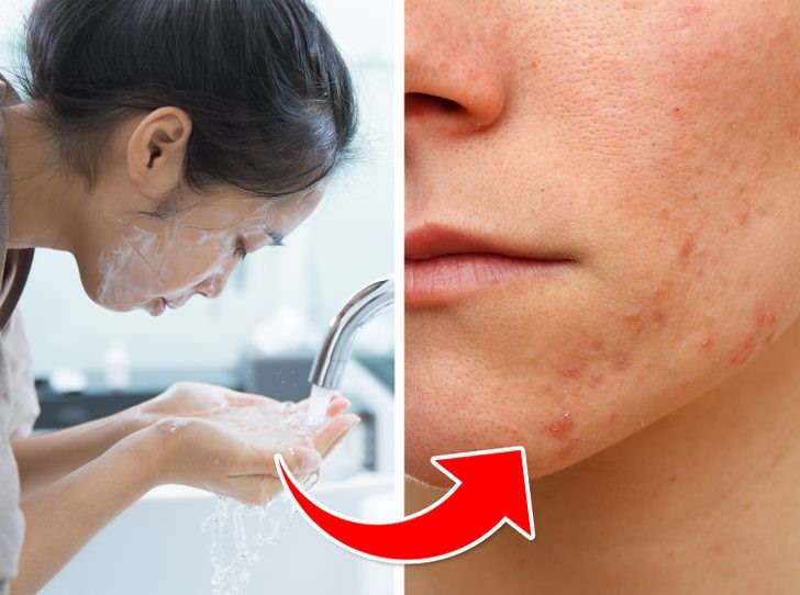 Sai lầm khi chăm sóc da mặt do rửa mặt quá nhiều