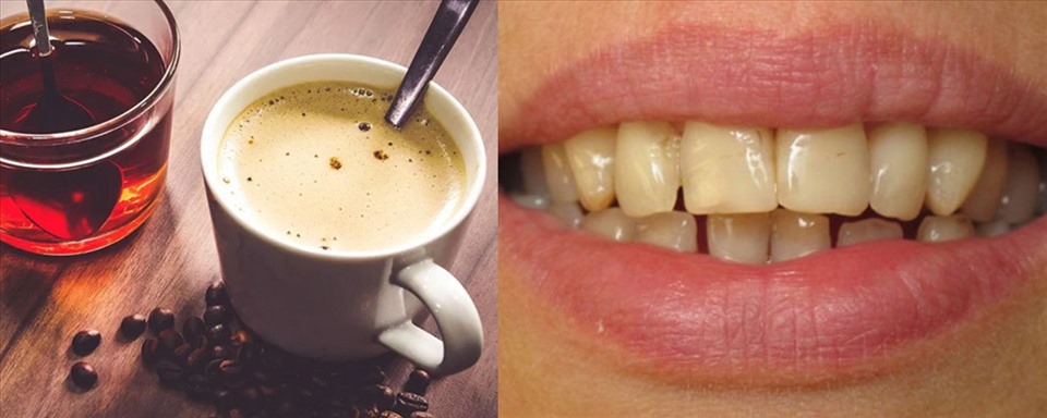 5 lưu ý quan trọng khi ăn uống giữ cho răng không bị ố vàng