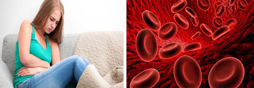 Ra máu quá nhiều trong kỳ kinh nguyệt có thể là dấu hiệu u xơ tử cung. Đồ họa: Hồng Nhật
