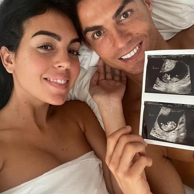 Ronaldo và Georgina chia sẻ hình ảnh siêu âm của 2 bé sinh đôi trên trang cá nhân. Ảnh: Instagram