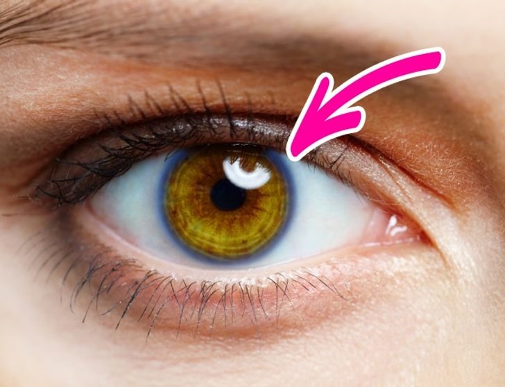 2. Xuất hiện vòng tròn xung quanh tròng mắt Những vòng tròn xung quanh tròng mắt xuất hiện khá phổ biến ở những người trên 50 tuổi. Tuy nhiên, nếu nó xuất hiện ở những người trẻ hơn thì đó là dấu hiệu cảnh báo mức cholesterol cao. Bạn nên tham khảo ý kiến ​​bác sĩ khi có dấu hiệu này.