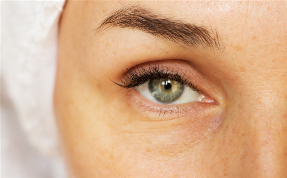 Nếp nhăn vùng da mắt xuất hiện rõ rệt bắt đầu ở lứa tuổi trung niên của chị em phụ nữ. Ảnh: Xinhua