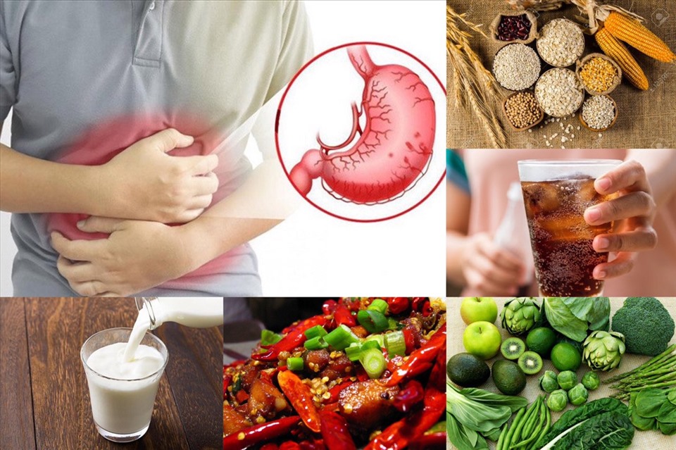 Một số loại thực phẩm phổ biến gây đau dạ dày. Đồ họa: A.N