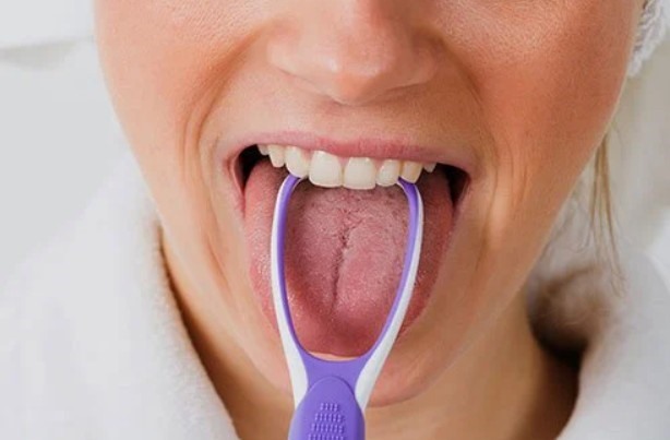 Không vệ sinh mặt sau lưỡi:  Mặt sau của lưỡi là nơi vi khuẩn có xu hướng tụ tập. Vi khuẩn trong cổ họng, bên dưới lưỡi và mặt sau của lưỡi sẽ phá vỡ các protein bên trong miệng của bạn. Khi chúng hoạt động, chúng giải phóng các hợp chất lưu huỳnh có mùi hôi.