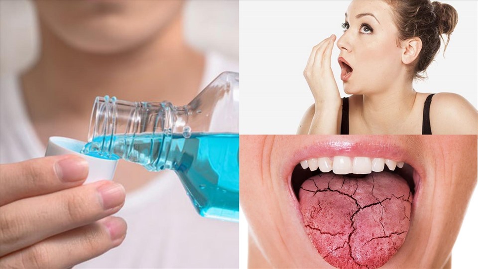 Giữ ẩm khoang miệng cũng là yếu tố quan trọng tránh tình trạng hôi miệng.  (Đồ họa: VA)