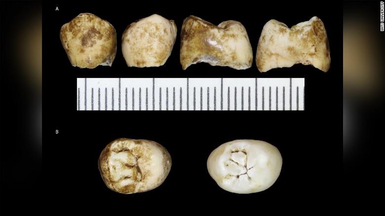 Răng hóa thạch em bé Homo naledi Leti. Ảnh: Đại học Witwatersrand
