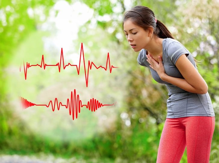 Tim đập nhanh Nhịp tim đập nhanh, có thể là một triệu chứng khác của thiếu sắt. Điều này là do lượng hemoglobin thấp có nghĩa là tim phải làm việc nhiều hơn để vận chuyển oxy đến phần còn lại của cơ thể. Trong trường hợp nghiêm trọng, điều này có thể dẫn đến suy tim.