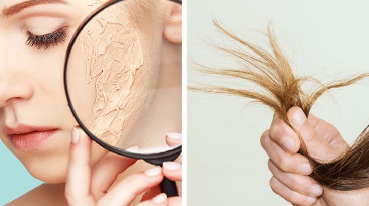 Tóc và da bị tổn thương Khi da và tóc thiếu sắt, chúng sẽ trở nên khô và mỏng manh hơn. Cư thể dự trữ lượng sắt thấp làm tăng tỷ lệ rụng tóc, đặc biệt là ở phụ nữ chưa mãn kinh.