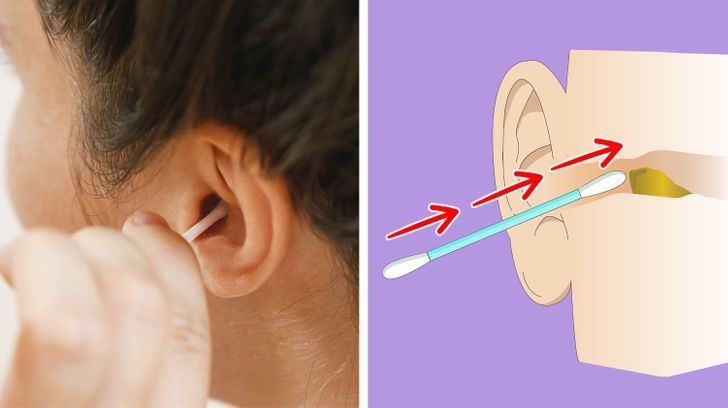Tăm bông là dụng cụ vệ sinh tai được sử dụng thường xuyên. Tuy nhiên, chỉ nên làm nhẹ nhàng. Nếu vệ sinh quá mạnh, tuy cảm nhận được sai sẽ khô và sạch hơn, nhưng tăm bông đã đẩy ráy tai vào sâu hơn trong tai, thậm chí nếu quá tay có thể làm hỏng màng nhĩ.