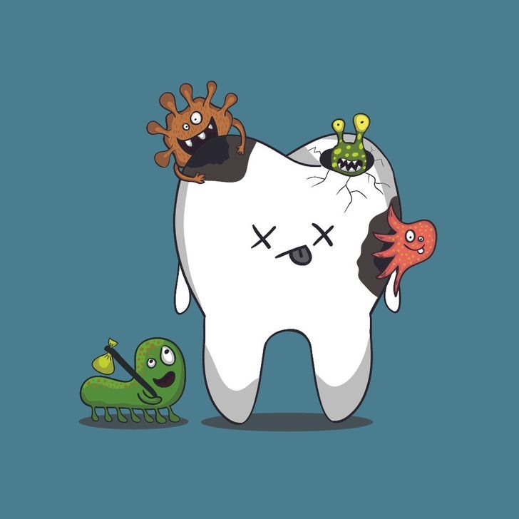 4. Sâu răng Thức ăn ngọt có thể gây ra tình trạng sâu răng. Tuy nhiên, không phải đường trực tiếp gây sâu răng mà chính là những mảnh vụn thức ăn còn sót lại trên răng sau khi bạn ăn gây ra tình trạng này. Nếu không được tiêu hóa hoặc chải răng đúng cách, các mảnh vụn thức ăn sẽ gây ra sự xuất hiện của mảng bám trên răng.