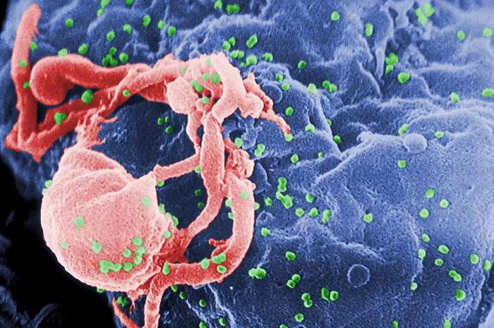 Virus HIV (màu xanh lá cây) đang lây nhiễm vào một tế bào. Ảnh: CDC/Cynthia Goldsmith